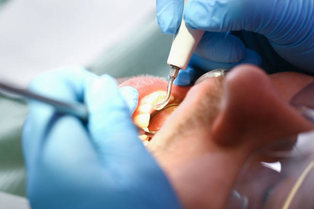Best Emergency Treatment for Oral Infections in Glenwood, AR