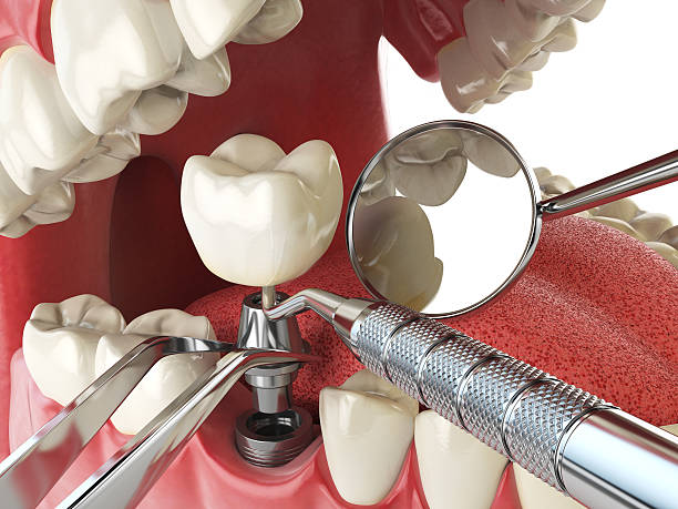 Professional Emergency Dental Service in AR
